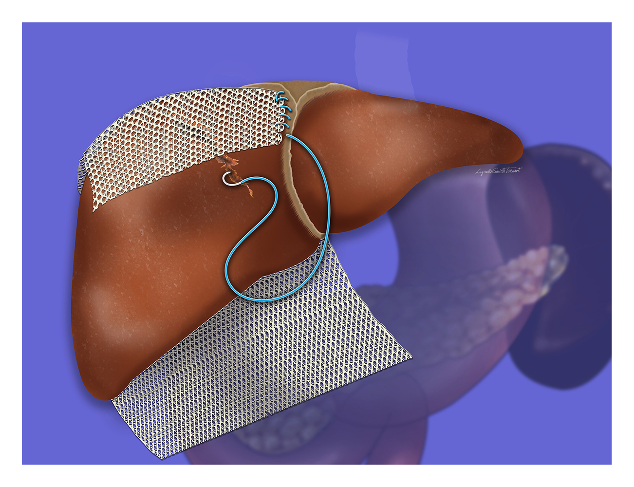 Digital Medical Illustration