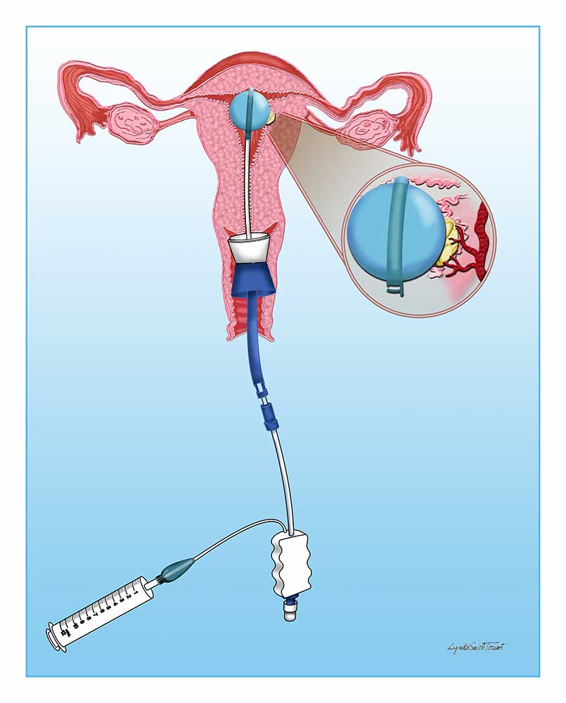 Digital Medical Illustration