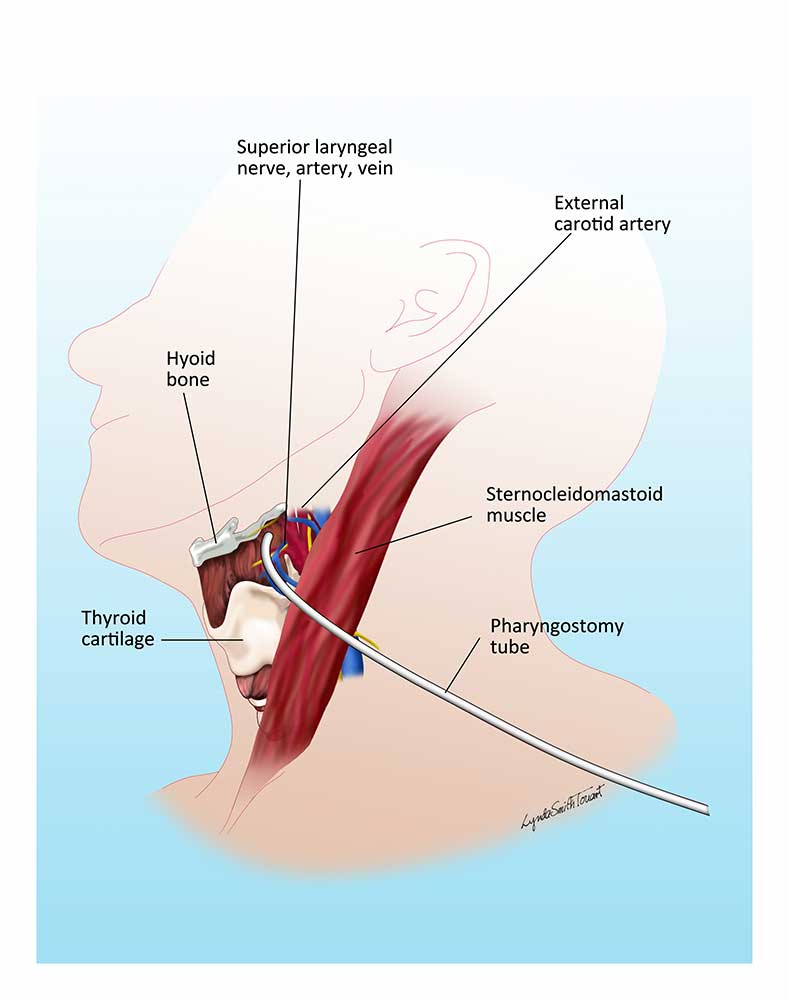Digital Medical Illustration