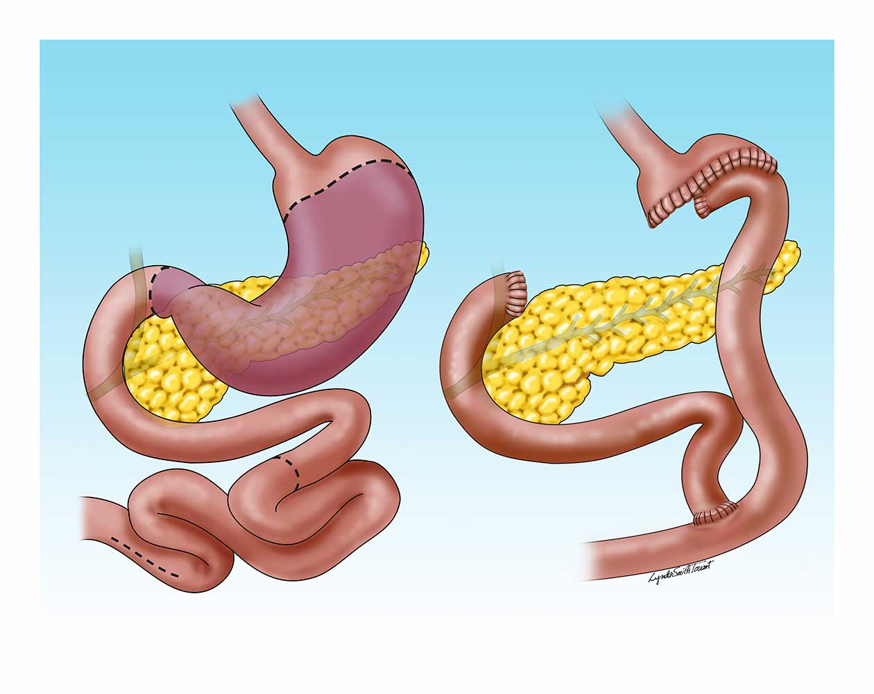 Digital Medical Illustration