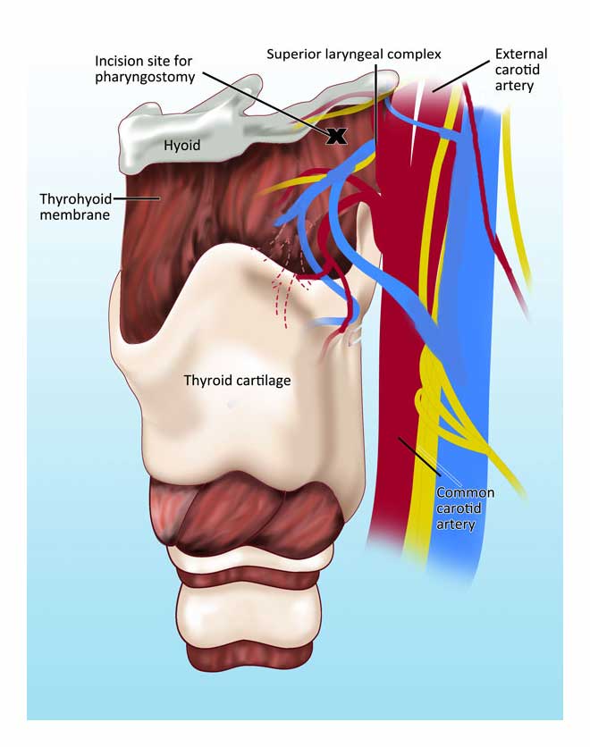 Digital Medical Illustration