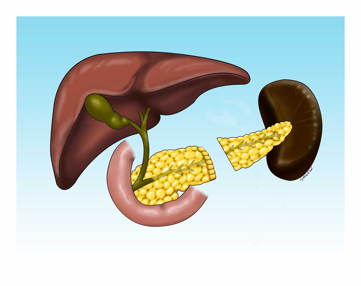 Digital Medical Illustration