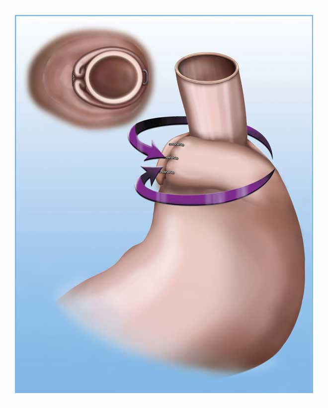 Digital Medical Illustration